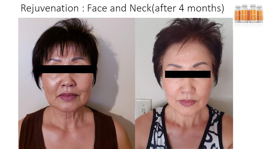 텔로유스,teloyouth, 텔로유스 한국,teloyouth 한국,telomega, telomega 텔로메가,surrean,수례안 120