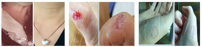 텔로유스,teloyouth, 텔로유스 한국,teloyouth 한국,telomega, telomega 텔로메가,surrean,수례안 33