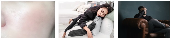 텔로유스,teloyouth, 텔로유스 한국,teloyouth 한국,telomega, telomega 텔로메가,surrean,수례안 35