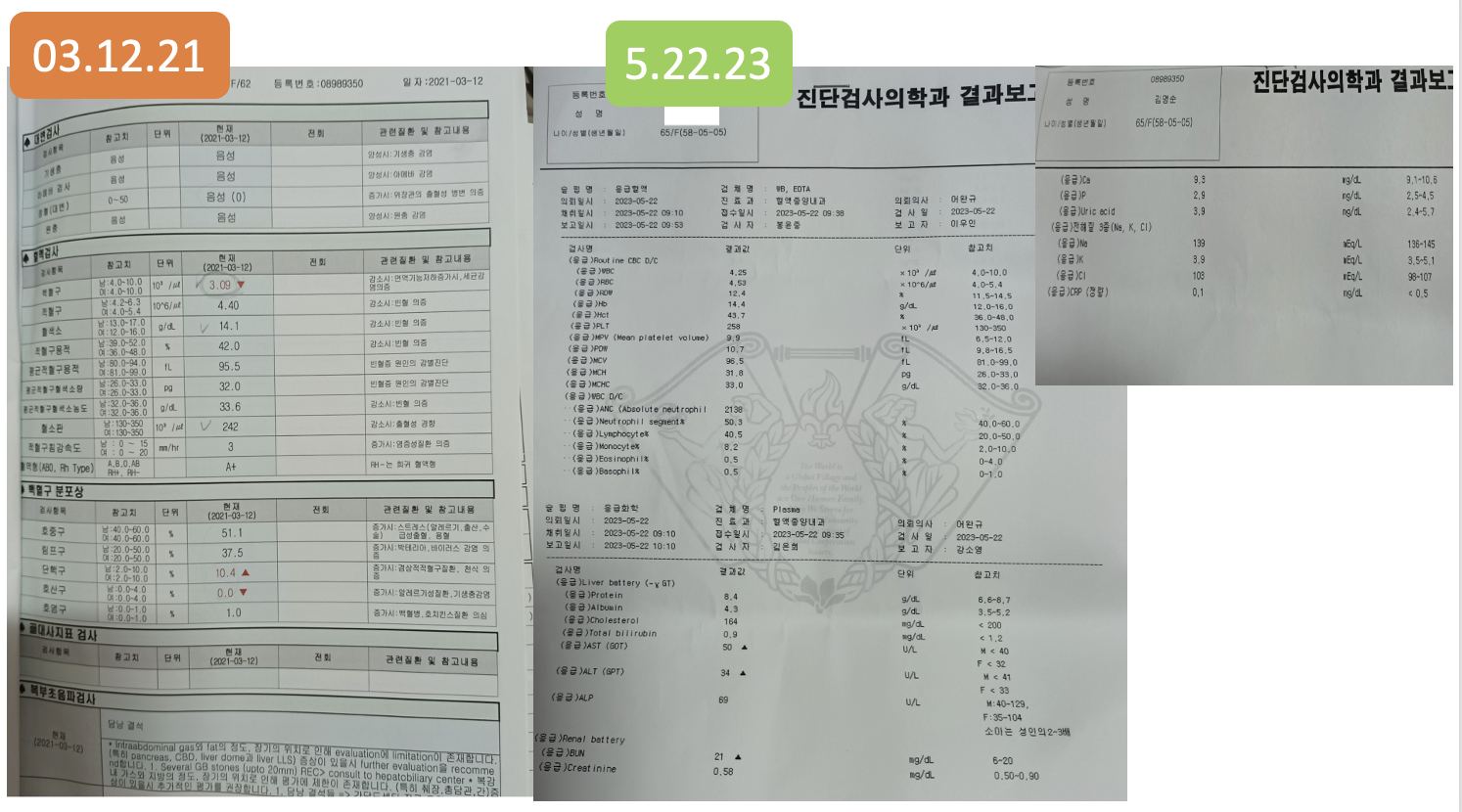 텔로유스,텔로유스 한국,텔로메가,텔로유스 파우더,텔로유스 서울,텔로유스 백혈구감소,텔로유스 협착증,텔로유스 성분