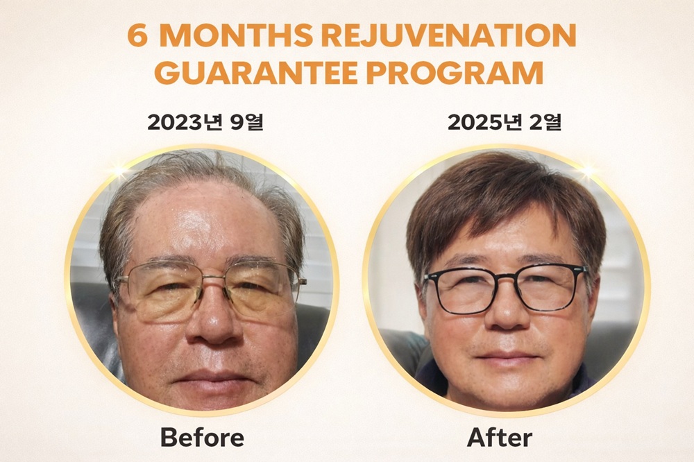 텔로유스,텔로유스 한국,텔로메가,텔로펫,수례안,텔로유스 파우더,001