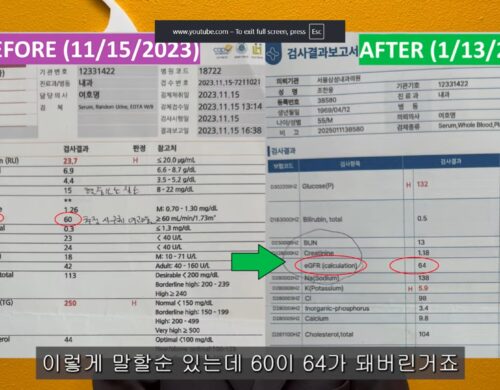 텔로유스-신장 수치 개선
